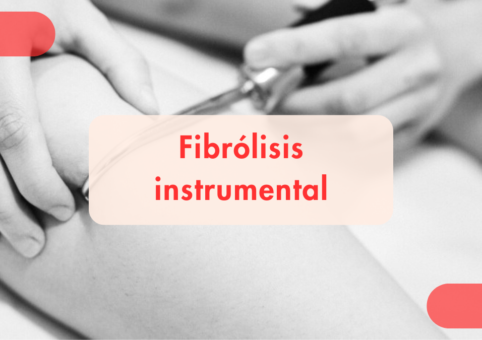 Tratamiento de fisioterapia con fibrólisis instrumental en Motrix Fisioterapia La Laguna