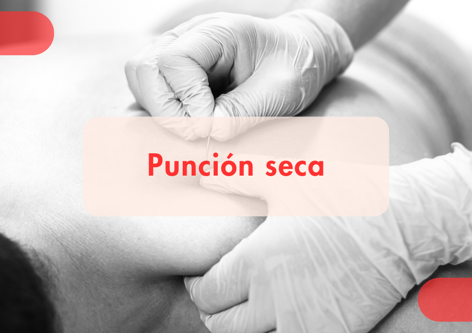 Fisioterapia con punción seca para aliviar contracturas musculares en Motrix Fisioterapia La Laguna